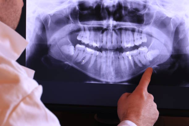 Best Emergency Dental Extractions in Eastport, NY