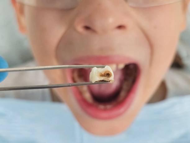 Best Pediatric Emergency Dentist in Eastport, NY