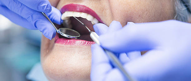 Best Emergency Dentist for Lost Fillings or Crowns in Eastport, NY